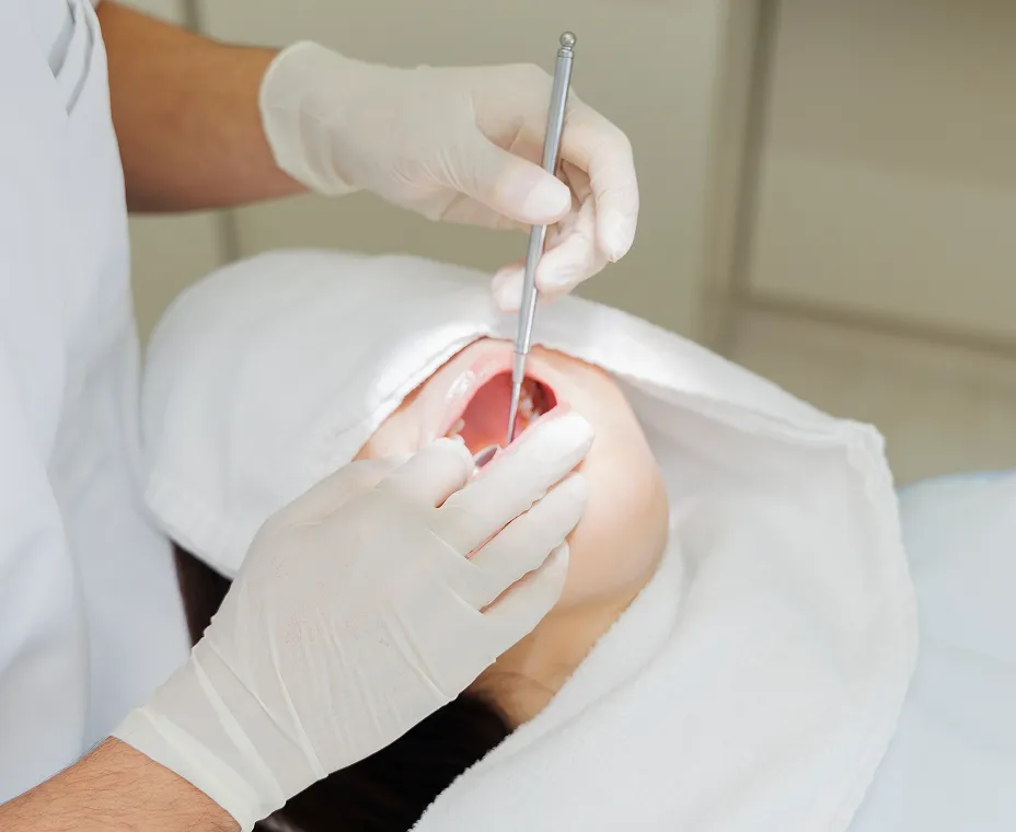 歯周病の予防・改善