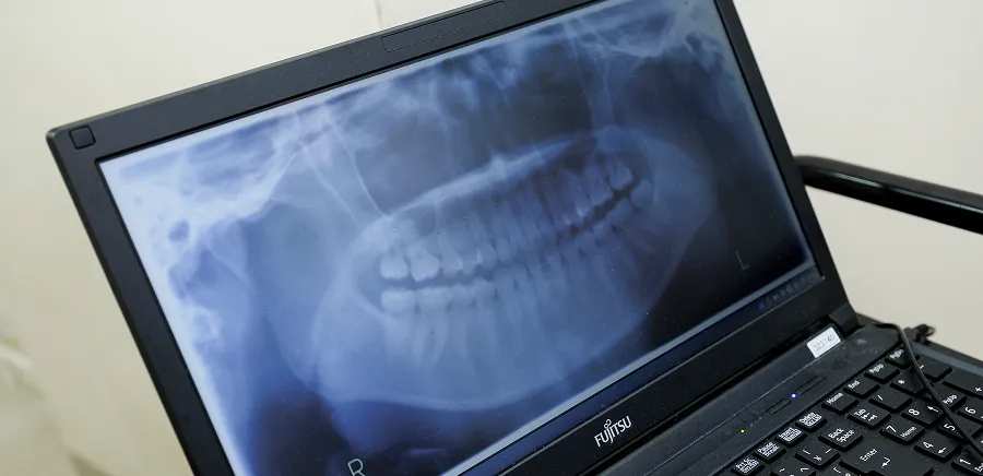 当院の補綴治療